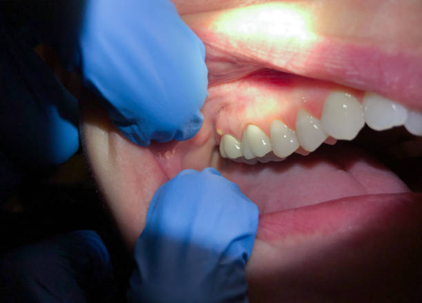 Best After-Hours Emergency Dentist in Jessup, MD