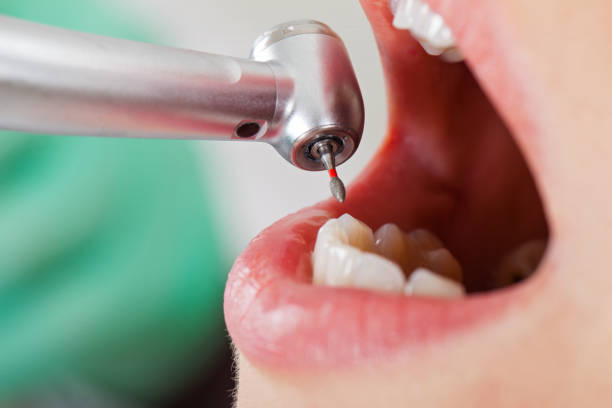 Best Emergency Broken Tooth Repair in Jessup, MD